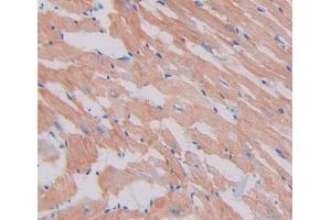 Figure. (MYH3 antibody  (AA 1593-1848))