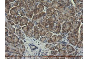 Image no. 1 for anti-serpin Peptidase Inhibitor, Clade B (Ovalbumin), Member 3 (SERPINB3) antibody (ABIN1500886) (SERPINB3 antibody)