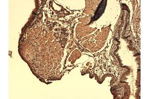 Immunohistochemistry analysis using Mouse Anti-Sodium Iodide Symporter Monoclonal Antibody, Clone 14F . (SLC5A5 antibody  (AA 468-643))