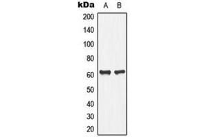 Western blot analysis of PLA2G4C expression in Jurkat (A), human pancreas (B) whole cell lysates. (PLA2G4C antibody  (Center))