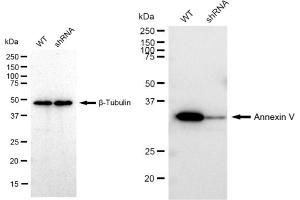 Western blotting analysis using Annexin V antibody (ABIN7797622).