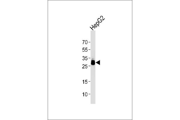 PPT1 抗体  (AA 1-306)