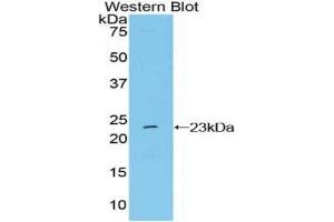 Western Blotting (WB) image for anti-NME/NM23 Nucleoside Diphosphate Kinase 6 (NME6) (AA 1-184) antibody (ABIN1860010) (NME6 antibody  (AA 1-184))