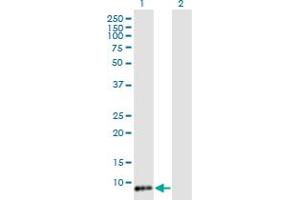 Western Blot analysis of TIMM8B expression in transfected 293T cell line by TIMM8B monoclonal antibody (M15), clone 8E5. (TIMM8B antibody  (AA 1-83))