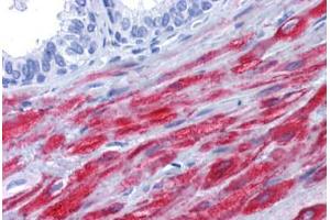 Human Prostate: Formalin-Fixed, Paraffin-Embedded (FFPE) (Smoothelin antibody)