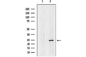 anti-Claudin 6 (CLDN6) antibody