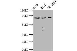 Western Blot Positive WB detected in: A549 whole cell lysate, 293T whole cell lysate, SH-SY5Y whole cell lysate All lanes: ZC3H14 antibody at 3. (ZC3H14 antibody  (AA 176-306))