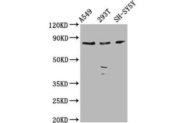 ZC3H14 抗体  (AA 176-306)