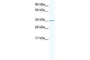 WB Suggested Anti-RNF130 Antibody Titration:  2. (RNF130 antibody  (N-Term))
