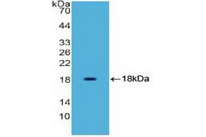 Detection of Recombinant HMGA1, Human using Polyclonal Antibody to High Mobility Group AT Hook Protein 1 (HMGA1) (HMGA1 antibody)