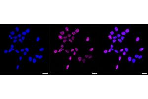 Immunocytochemical staining of HAP-1 cells with Phospho-Rad17 (S656) antibody (ABIN7800113), 1:1,000). (Recombinant RAD17 antibody  (pSer656))