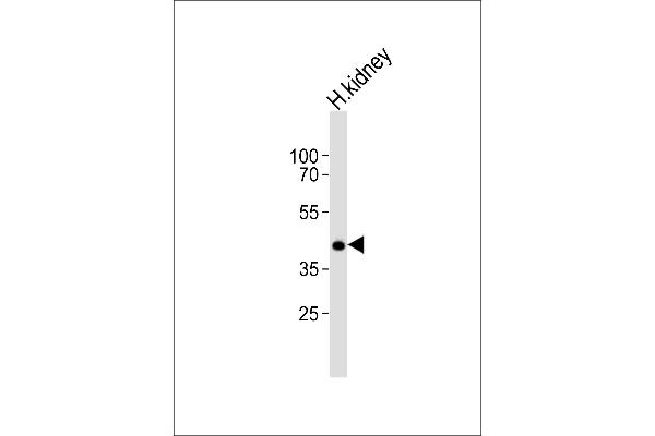 PCGF6 antibody  (C-Term)