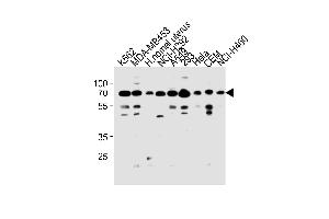 Western Blotting (WB) image for anti-Poly (ADP-Ribose) Polymerase Family, Member 3 (PARP3) (AA 99-126), (N-Term) antibody (ABIN1881632)