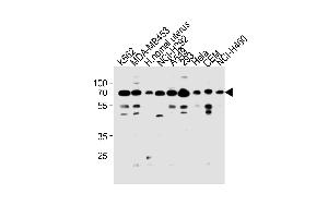 RP3 Antibody (N-term) (ABIN1881632 and ABIN2843271) western blot analysis in K562,MDA-M,NCI-,A549,293,Hela,CEM,NCI- cell line and human nomal uterus tissue lysates (35 μg/lane). (PARP3 antibody  (N-Term))
