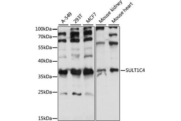 SULT1C4 抗体  (AA 1-95)