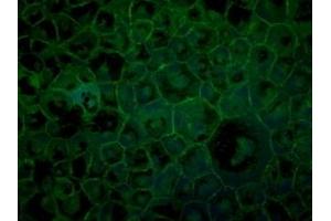 Immunofluorescence (IF) image for anti-Tight Junction Protein 1 (TJP1) (C-Term) antibody (ABIN6254231)