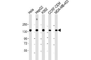 All lanes : Anti-C3 Antibody (C-term) at 1:2000 dilution Lane 1: Hela whole cell lysate Lane 2: HepG2 whole cell lysate Lane 3: K562 whole cell lysate Lane 4: CCRF-CEM whole cell lysate Lane 5: MDA-MB-453 whole cell lysate Lysates/proteins at 20 μg per lane. (C3 antibody  (AA 1353-1382))