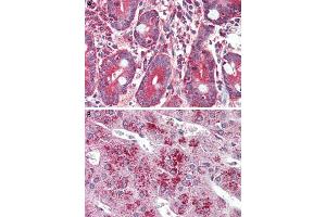 Immunohistochemistry (Formalin/PFA-fixed paraffin-embedded sections) of human small intestine (A) and human adrenal gland (B) tissue with GLP2R polyclonal antibody . (GLP2R antibody  (C-Term))