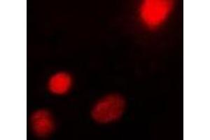 Immunofluorescent analysis of USF1 staining in Hela cells. (USF1 antibody)