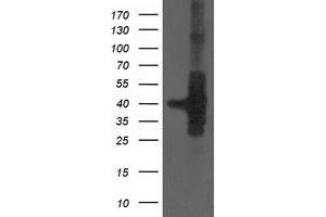 Western Blotting (WB) image for anti-HSPA Binding Protein, Cytoplasmic Cochaperone 1 (HSPBP1) antibody (ABIN1498759) (HSPBP1 antibody)