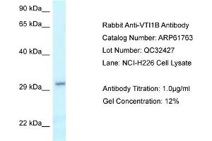 Western Blotting (WB) image for anti-Vesicle Transport through Interaction with T-SNAREs Homolog 1B (VTI1B) (C-Term) antibody (ABIN2788893) (VTI1B antibody  (C-Term))