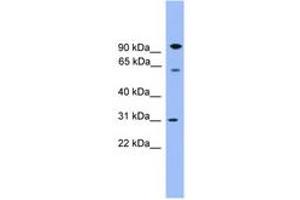 Image no. 1 for anti-Copine VI (CPNE6) (AA 401-450) antibody (ABIN6746586) (CPNE6 antibody  (AA 401-450))