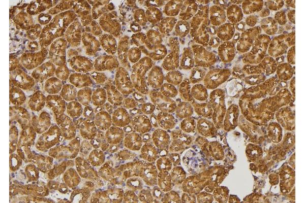 RALGAPA2 antibody  (Internal Region)