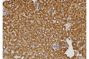 ABIN6274590 at 1/100 staining Mouse kidney tissue by IHC-P. (RALGAPA2 antibody  (Internal Region))