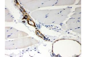 Immunohistochemistry (IHC) image for anti-BCL2-Antagonist/killer 1 (BAK1) (AA 22-211) antibody (ABIN4950296)