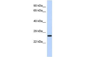 WB Suggested Anti-EFHD2 Antibody Titration: 0. (EFHD2 antibody  (N-Term))
