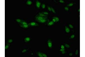 Immunofluorescent analysis of Hela cells using ABIN7151635 at dilution of 1:100 and Alexa Fluor 488-congugated AffiniPure Goat Anti-Rabbit IgG(H+L) (Nth Endonuclease III-Like 1 (NTHL1) (AA 31-312) antibody)