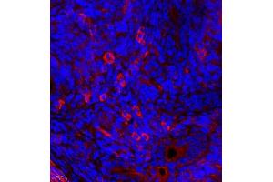 Immunofluorescence of paraffin embedded mouse uterus using MYL6 (ABIN7074734) at dilution of 1:650 (400x lens) (MYL6 antibody)