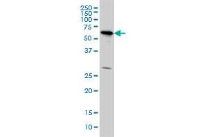 OXSR1 monoclonal antibody (M10), clone 3F6 Western Blot analysis of OXSR1 expression in HeLa . (OXSR1 antibody  (AA 351-450))