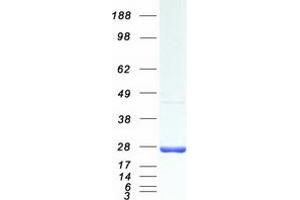 Validation with Western Blot (RAB1A Protein (Transcript Variant 1) (Myc-DYKDDDDK Tag))