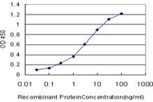 Detection limit for recombinant GST tagged OTX1 is approximately 0. (OTX1 antibody  (AA 10-116))