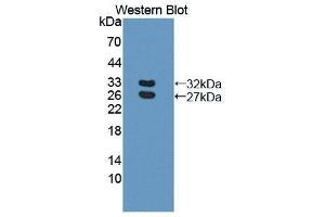 Western Blotting (WB) image for anti-Basal Cell Adhesion Molecule (Lutheran Blood Group) (BCAM) (AA 32-257) antibody (ABIN1866870)