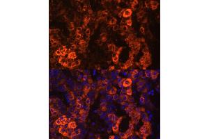 Immunofluorescence analysis of human liver cancer cells using BHMT antibody (ABIN3021749, ABIN3021750, ABIN3021751 and ABIN6215748) at dilution of 1:100. (BHMT antibody  (AA 177-406))