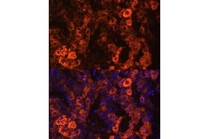 Immunofluorescence analysis of human liver cancer cells using BHMT antibody (ABIN3021749, ABIN3021750, ABIN3021751 and ABIN6215748) at dilution of 1:100. (BHMT antibody  (AA 177-406))