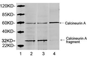 Lane 1: MarkerLane 2: Hela cell lysateLane 3: HEK293 cell lysateLane 4: NIH/3T3 cell lysateWestern blot analysis of cell lysates using 1 µg/mL Rabbit Anti-Calcineurin A Polyclonal Antibody (ABIN398733) The signal was developed with IRDyeTM 800 Conjugated Goat Anti-Rabbit IgG.