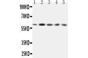 Anti-GRB7 antibody, All Western blottingAll lanes: Anti-GRB7 at 0. (GRB7 antibody  (Middle Region))