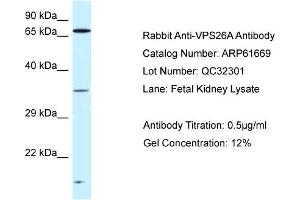 Western Blotting (WB) image for anti-Vacuolar Protein Sorting-Associated Protein 26A (VPS26A) (C-Term) antibody (ABIN2788866)