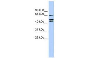 Image no. 1 for anti-Zinc Finger Protein 578 (ZNF578) (AA 107-156) antibody (ABIN6741085)