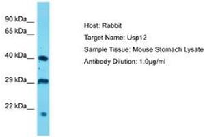 Image no. 1 for anti-Ubiquitin Specific Peptidase 12 (USP12) (AA 89-138) antibody (ABIN6750350) (USP12 antibody  (AA 89-138))