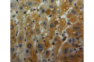 Used in DAB staining on fromalin fixed paraffin-embedded liver tissue
