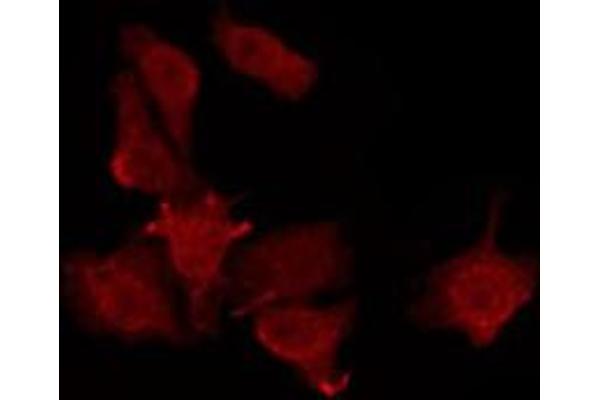 KCNJ9 antibody  (C-Term)