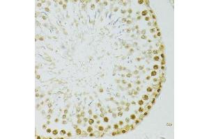 Immunohistochemistry of paraffin-embedded rat testis using ADAR antibody. (ADAR antibody  (AA 150-250))