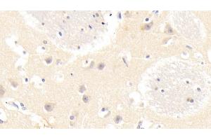 Immunohistochemistry (IHC) image for anti-GABA(A) Receptor-Associated Protein-Like 2 (GABARAPL2) (AA 1-117) antibody (ABIN7442576)