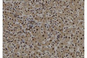 ABIN6272987 at 1/100 staining Human liver tissue by IHC-P. (ARL3 antibody  (C-Term))
