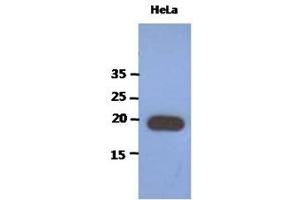 The extracts of HeLa (40ug) were resolved by SDS-PAGE, transferred to PVDF membrane and probed with anti-human PAIP2 antibody (1:1000).