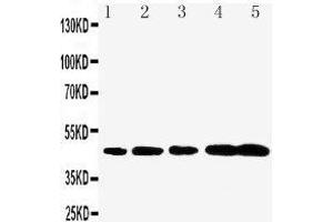 Anti-Caspase-1(P20) antibody,  Western blotting Lane 1: Rat Brain Tissue Lysate Lane 2: Rat Spleen Tissue Lysate Lane 3: Mouse Brain Tissue Lysate Lane 4: Mouse Spleen Tissue Lysate Lane 5: Mouse Testis Tissue Lysate (Caspase 1 antibody  (N-Term))